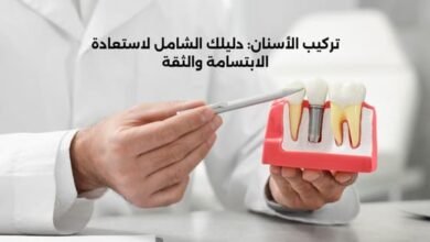 تركيب الأسنان: دليلك الشامل لاستعادة الابتسامة والثقة