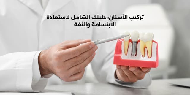 تركيب الأسنان: دليلك الشامل لاستعادة الابتسامة والثقة